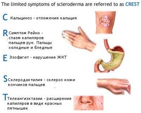 sklerodermia