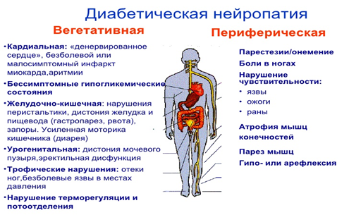 Полинейропатия - причины, типы, симптомы, признаки, диагностика, лечение, прогноз